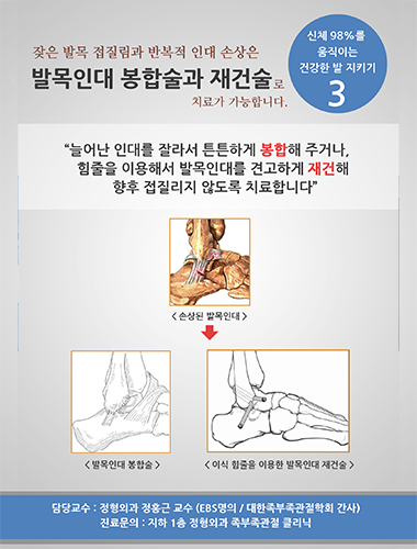 발목인대 봉합술과 재건술